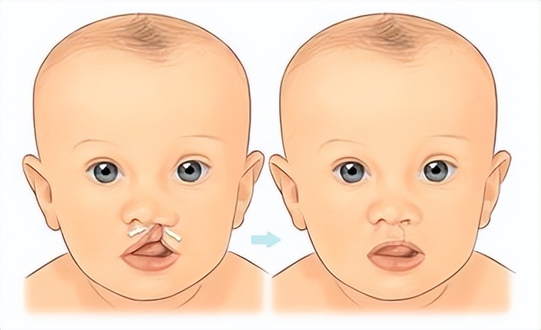 叶酸备孕怎么吃才正确,备孕期正确吃叶酸的方法