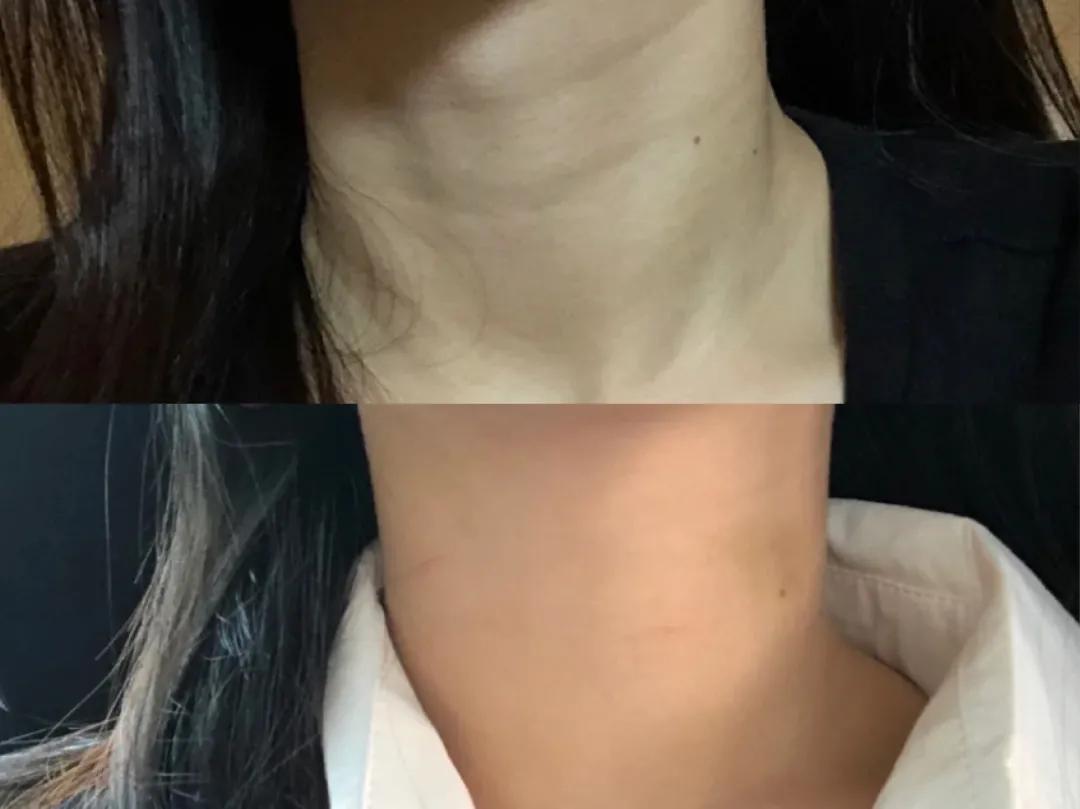 在*裤内**里加燕窝和胶原这种鬼话都说得出来？