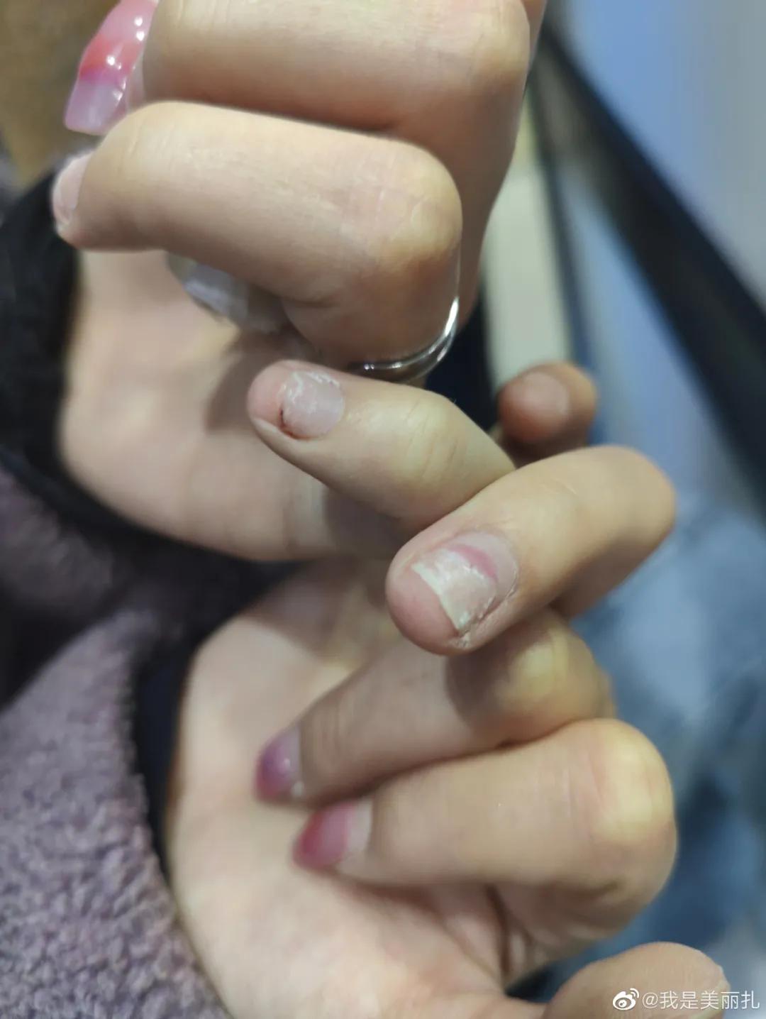 山东鲁能成源打人处置是否合理,遭成源殴打女子发声