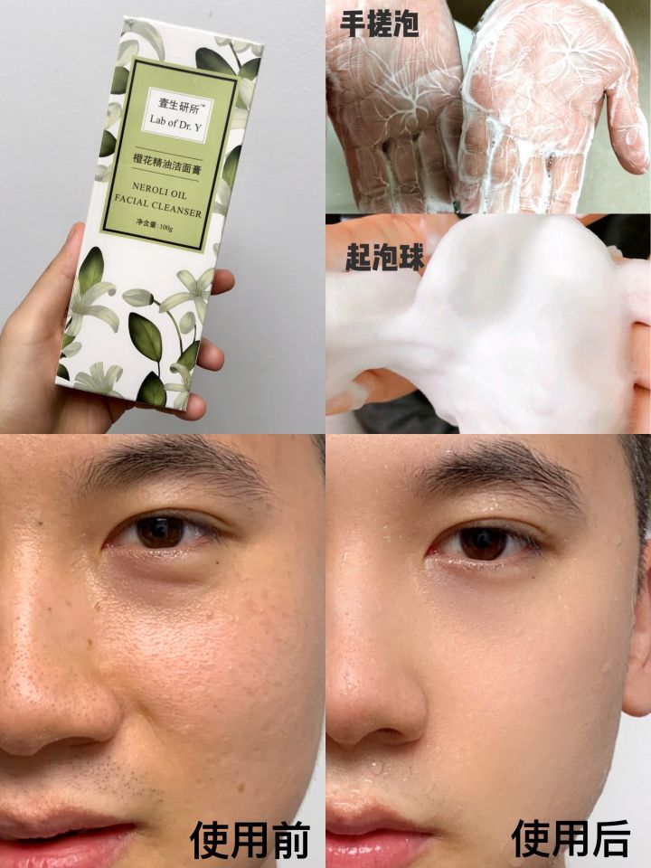 油皮护肤是用精华还是面霜还是乳,学生党整套护肤品200元油皮