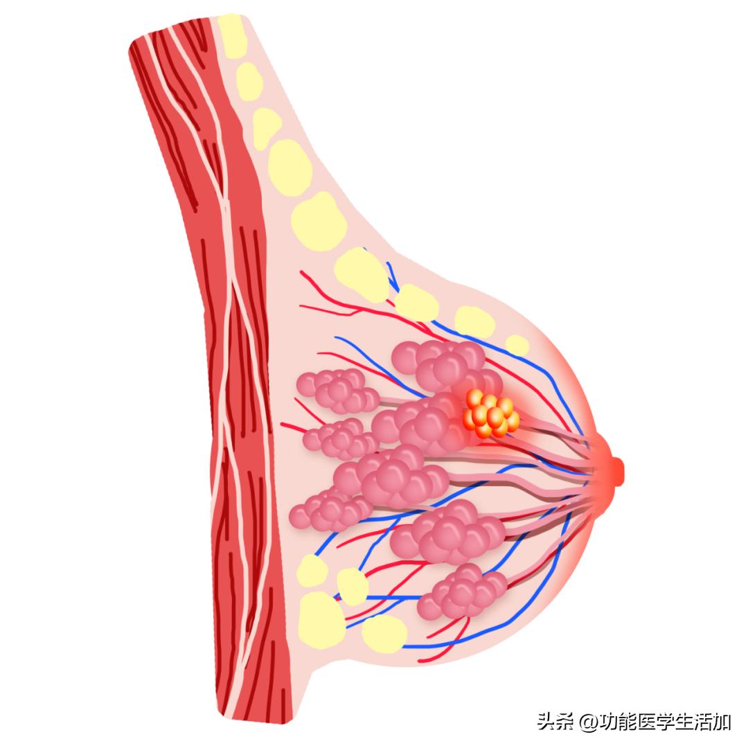 乳腺增生治疗费用大概多少,乳腺增生和囊肿需要治疗吗