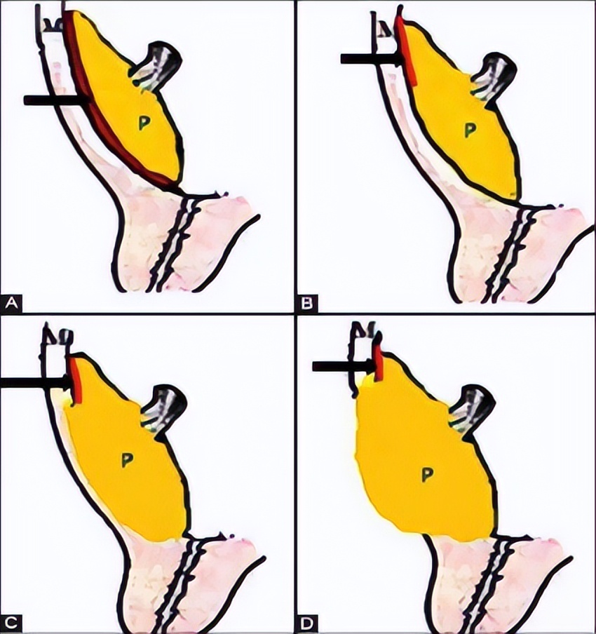 防控疫情我们在一起致敬逆行者,疫情之下我们拼尽全力