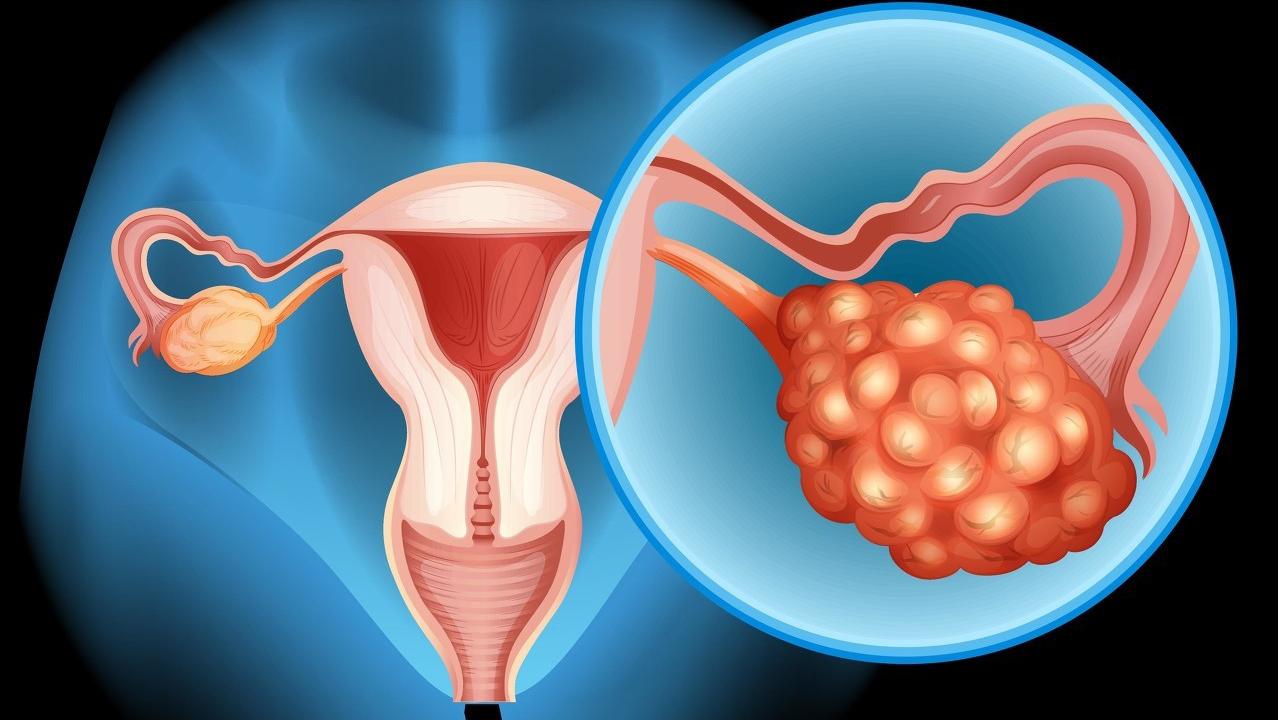 女人的子宫往下掉怎么治疗,女人老了子宫脱落的症状