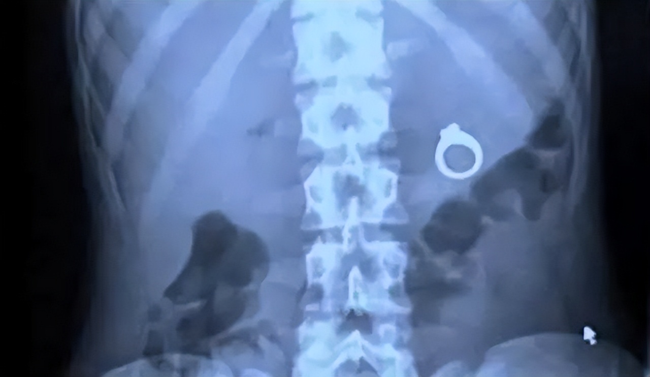 这些东西都能塞进身体里？就离谱