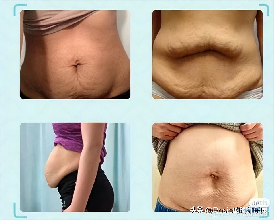 生育损伤合集,生育损伤有哪些