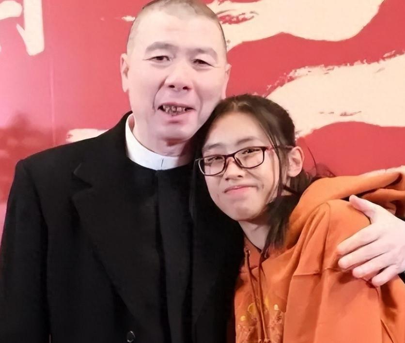 冯小刚的白癜风能治吗,冯小刚患白癜风视频