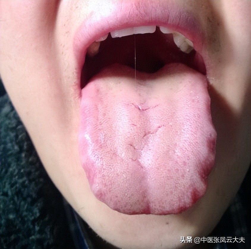 张锡纯散结汤,张锡纯疏肝理气中药方