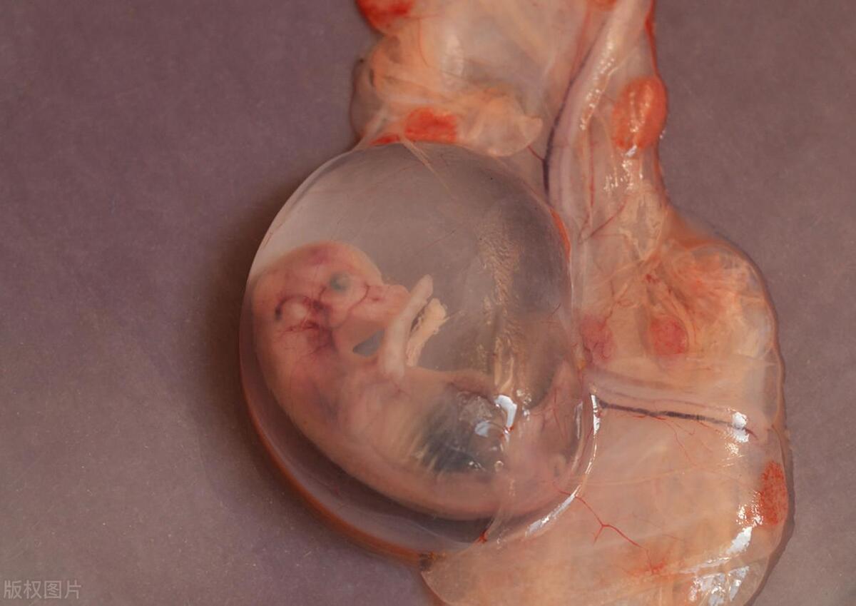 女人超过三次流产会有哪些危害,女性一生可以承受几次流产