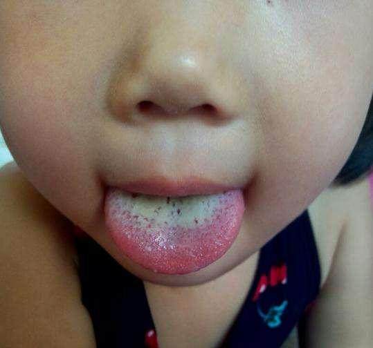 孩子不长个也不长肉中医怎么调理,孩子不长个不长肉补什么