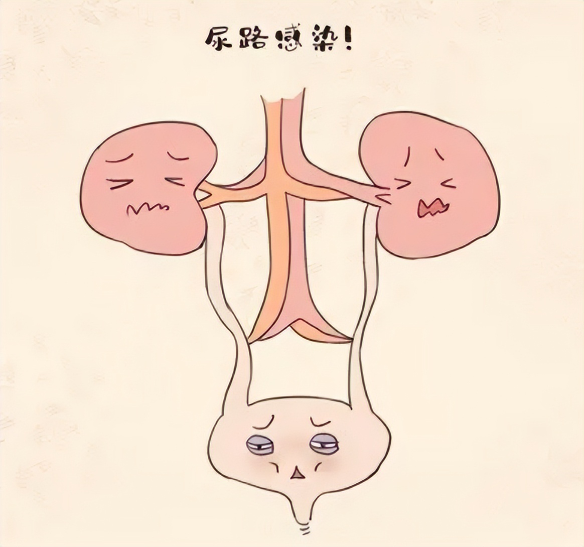 不想被感染要做到几点,自己动手治愈尿路感染的小窍门