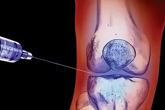 封闭针的药效对人体的伤害有多大,封闭针是将神经杀死吗