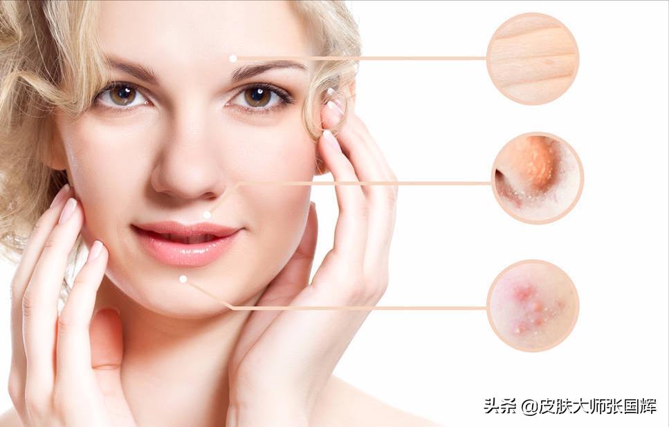 年轻人有痘痘要吃什么好,有痘痘吃什么更容易让它消失