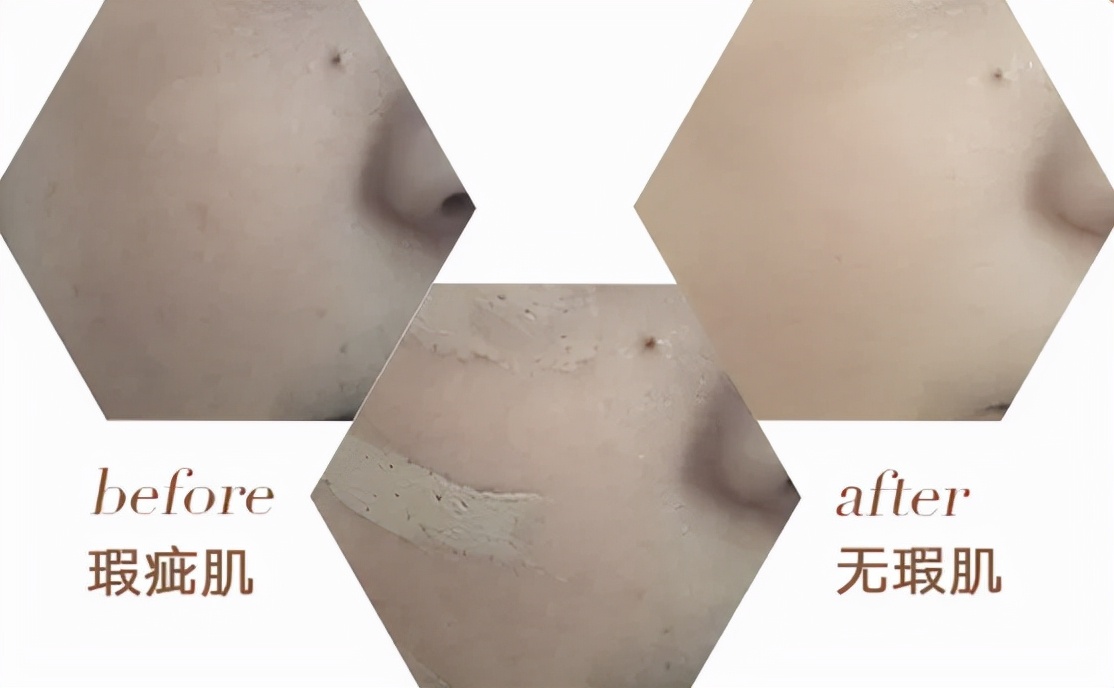 贫民窟女孩常用的护肤品绝不踩雷,贫民窟女孩用不起大牌