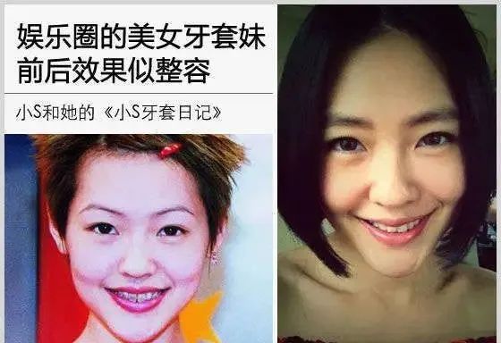 推荐牙科产品被曝含有禁药大S的瓜吃出了“好罚”的味道