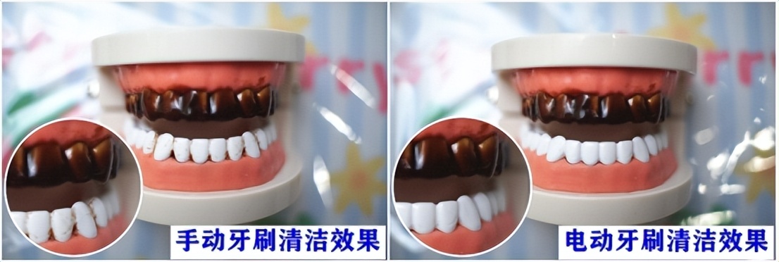 儿童电动牙刷对孩子牙齿有伤害么,牙齿容易出血可以用电动牙刷吗