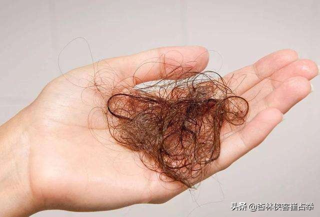 血虚血热脱发有哪些症状,血虚脱发吃什么药最好