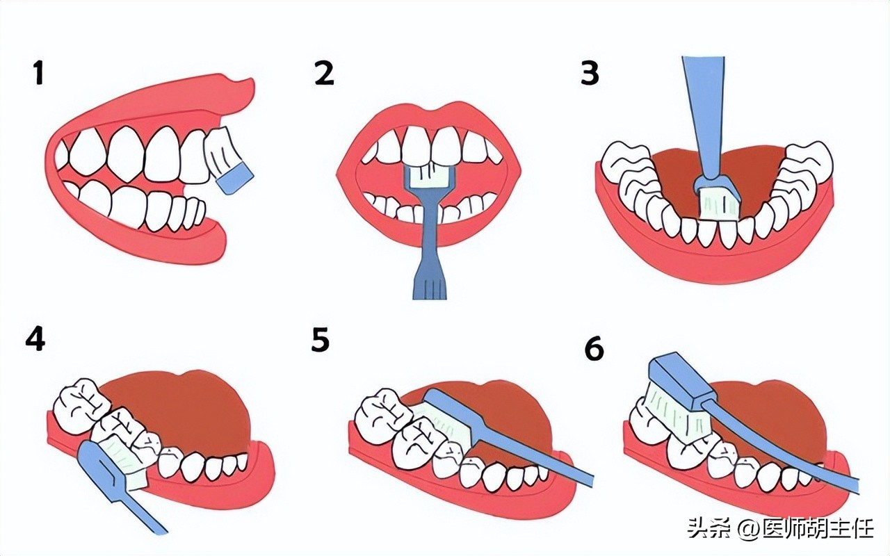 在牙缝里的牙结石要怎么去除,牙缝的牙结石怎么自己去除