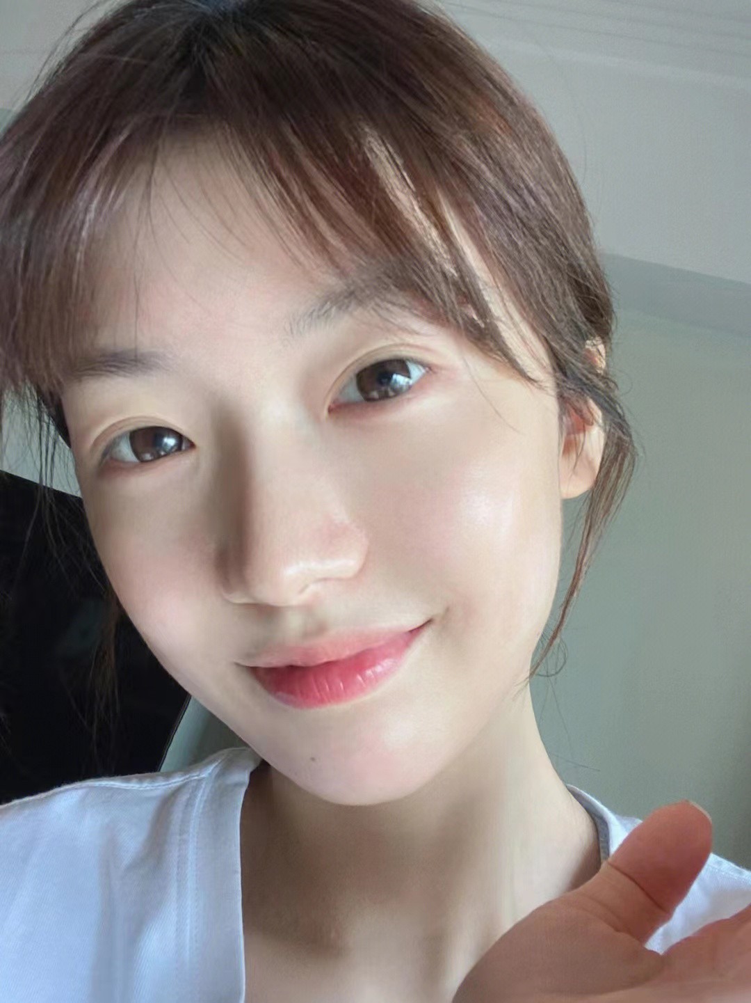 痘痘的10大常见说法你了解多少,关于痘痘的科普知识有哪些