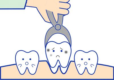 拔完牙医生让口水吞下去,拔完牙齿医生为什么说吞下口水