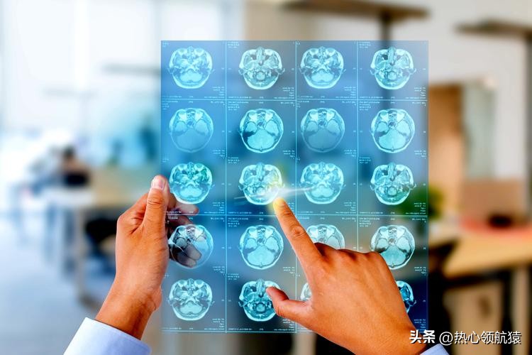 医学影像学真的好吗,医学影像学的真实现状