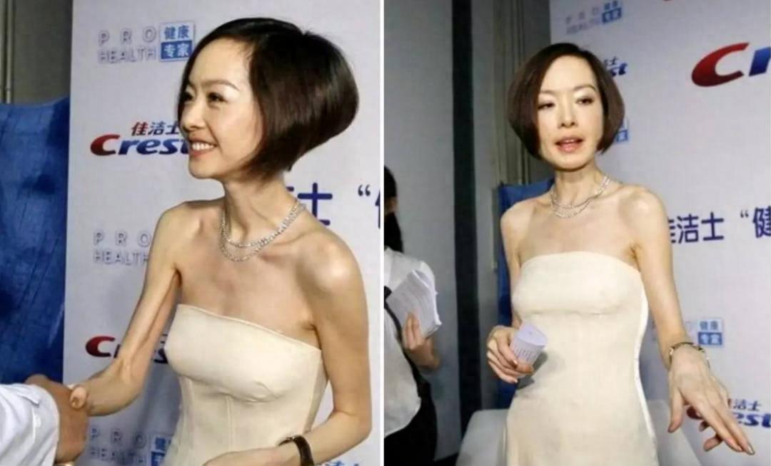 瘦得脱相的女人,瘦到脱相的女明星真的好看吗