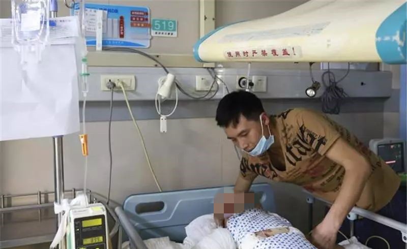 2岁女童被烧伤现场哭声让人揪心,6岁孩子被火烧伤后续