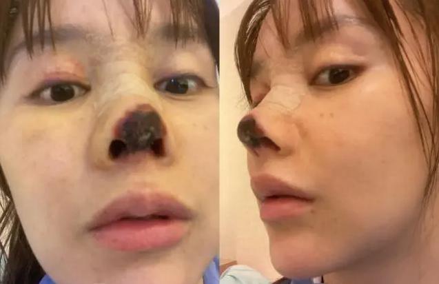 整容毁掉的四位女星,盘点整容失败惨不忍睹的十大女星