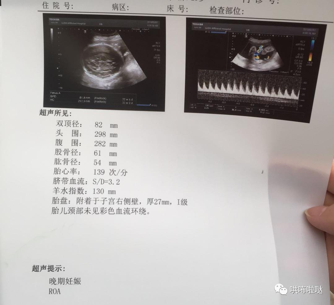 怀胎十月终于要卸货,回忆一下刚出生的宝宝