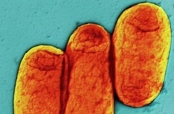 世界上最致命的病毒九种,细菌和病毒哪个更致命