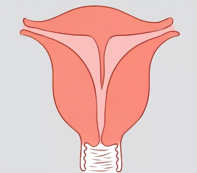 七种子宫形状，你了解过吗？