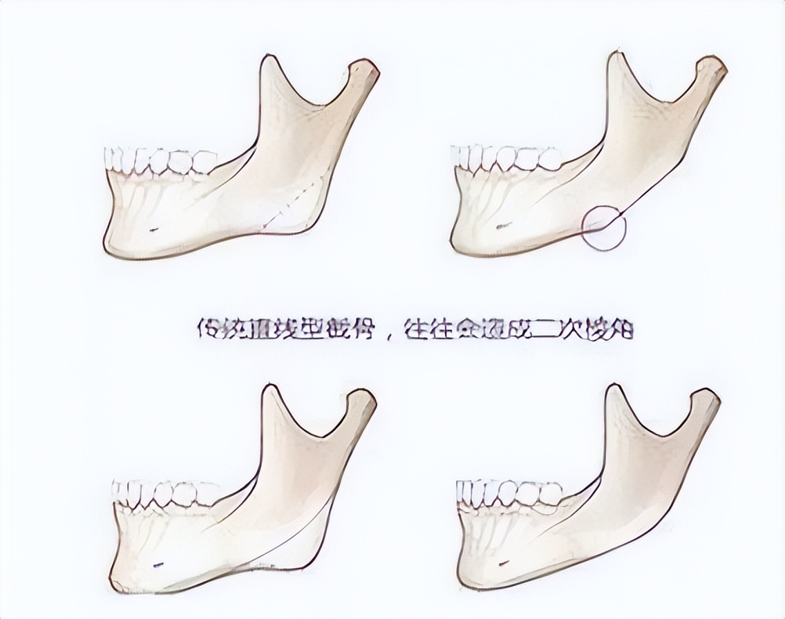 从“相貌平平”到千娇百媚，这7位女星的脸，前后差距让人破大防