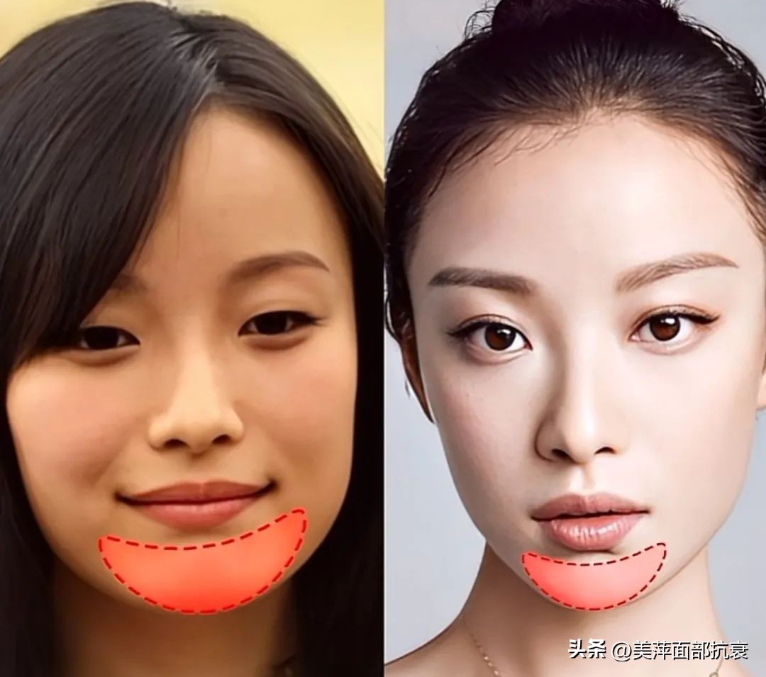 5个变美细节摆脱土气,方圆脸淡颜系女生变美思路