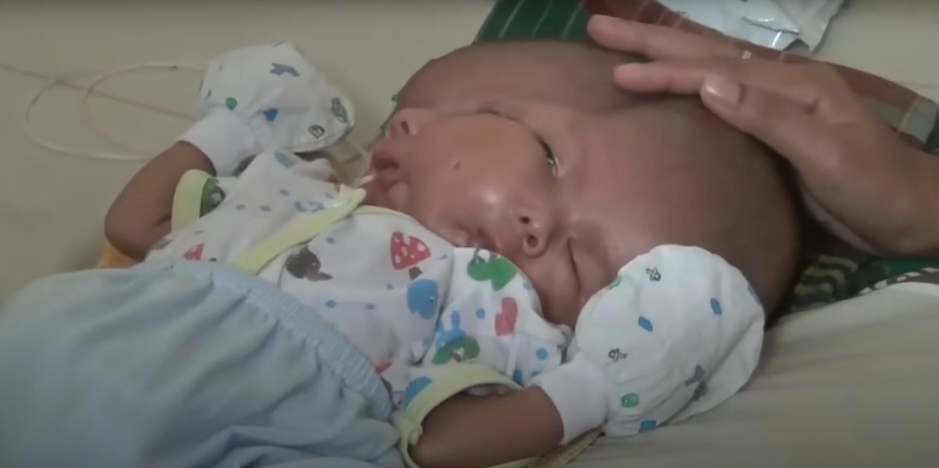 10个难以置信的人类，树皮人、外星人、拥有粗壮手臂的大力水手