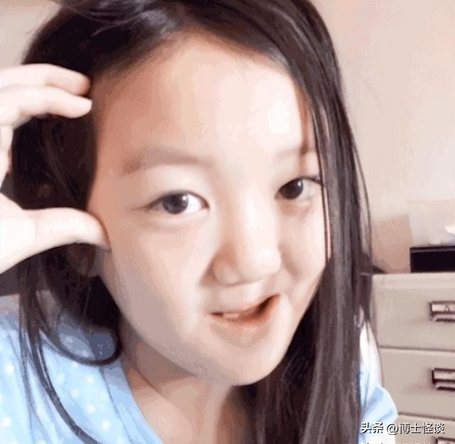 王菲女儿兔唇可以修复好吗,王菲女儿兔唇原来很严重吗