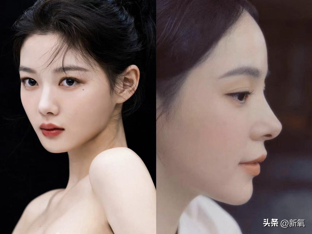 改一点赢很大？她整完鼻子直接美成断代神颜…