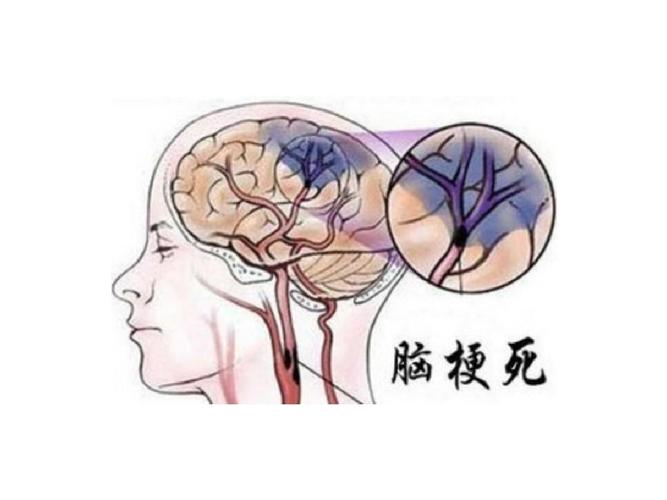 憋尿一时爽，膀胱“火葬场”！医生坦言：天再冷也不要憋尿