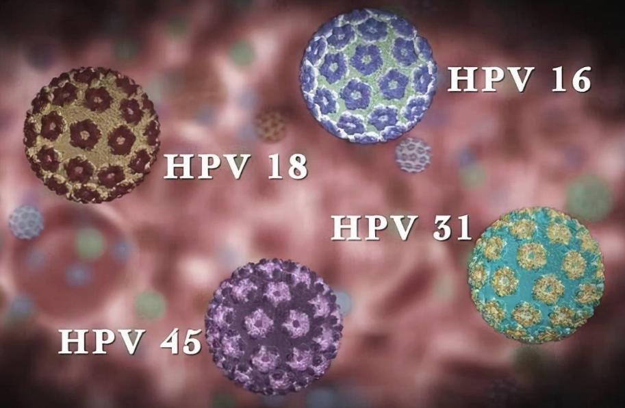 不论男女，身上长出这5种“瘊子”，或已感染HPV病毒！千万别轻视