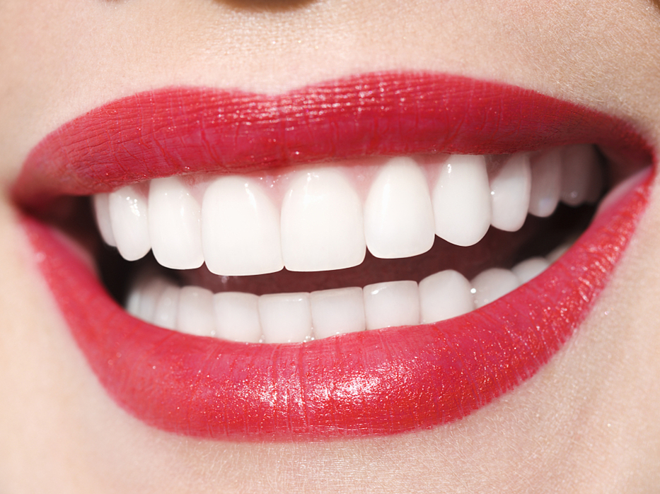 artsmile,Artsmile牙齿隐形矫正