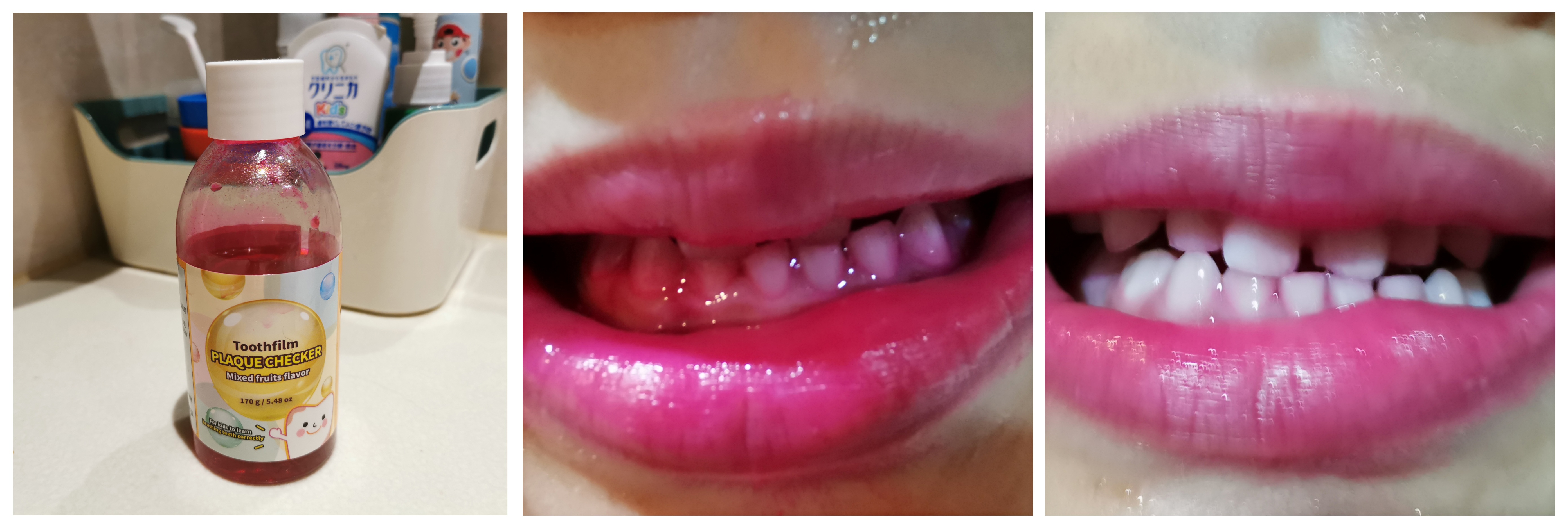 儿童电动牙刷什么档对牙好,哪个品牌儿童电动牙刷好用