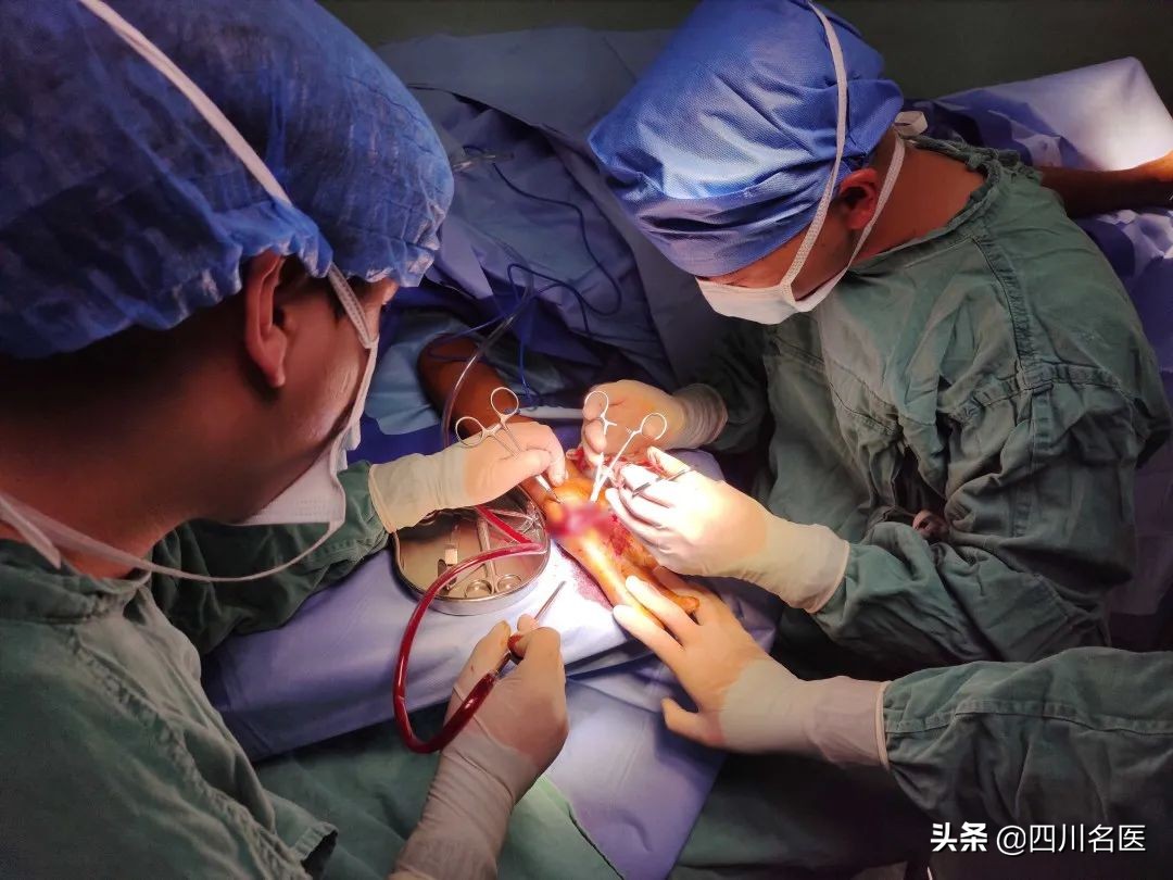 大拇指断了接上后怎么康复训练,大拇指断了接上后遗症