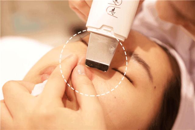 额头眉心发红有闭口粉刺,眉心鼻头频繁起粉刺怎么办