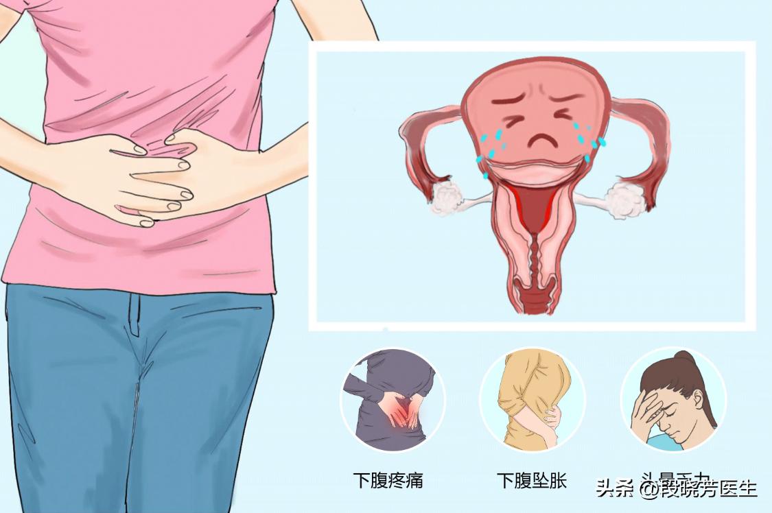 多囊卵巢中医辨证分型,多囊卵巢月经推迟中医辨证分型