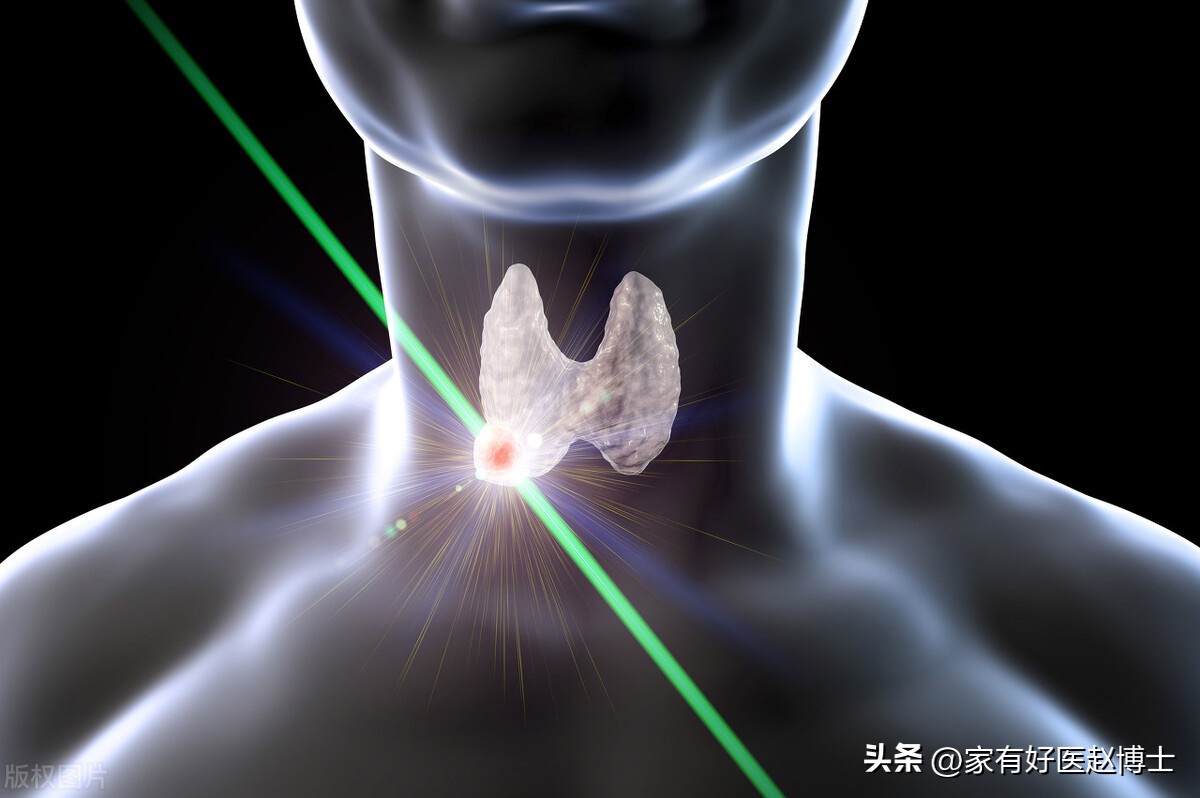 甲状腺结节诊治指南再更新,风险高低怎么看?哪些结节要穿刺?