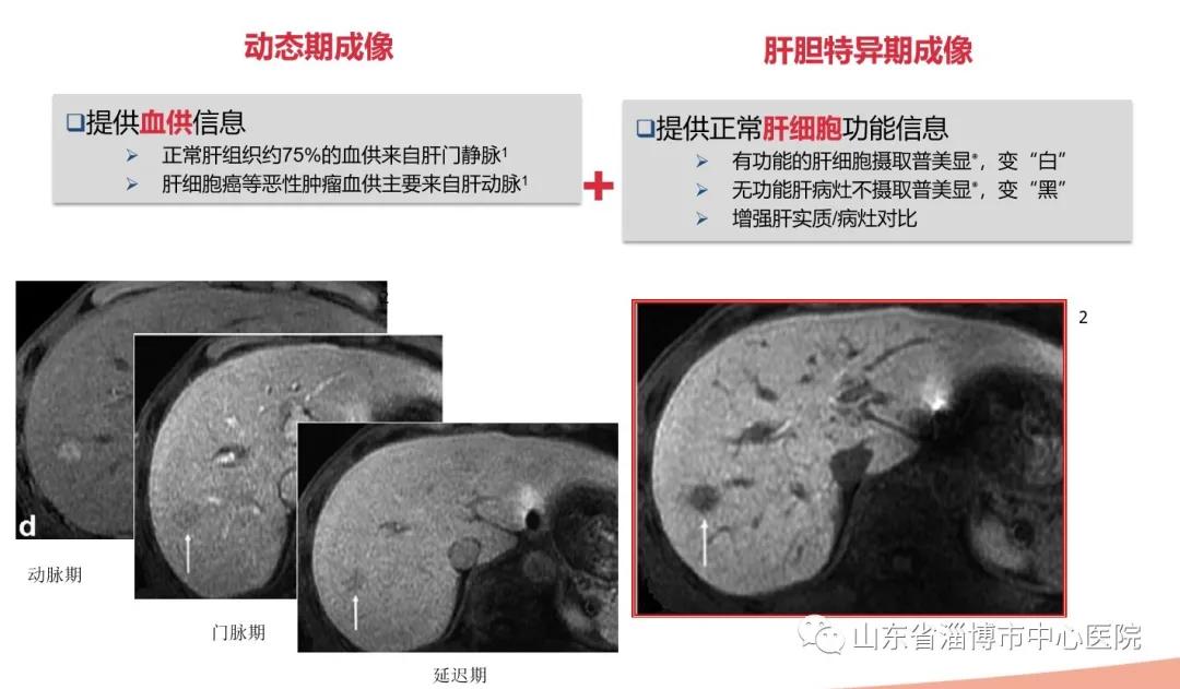 肝胆特异性对比剂检查的意义,肝胆特异性对比剂影像表现