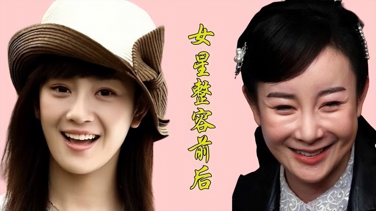 女人整容一模一样,女人整容之前与整容之后的样子