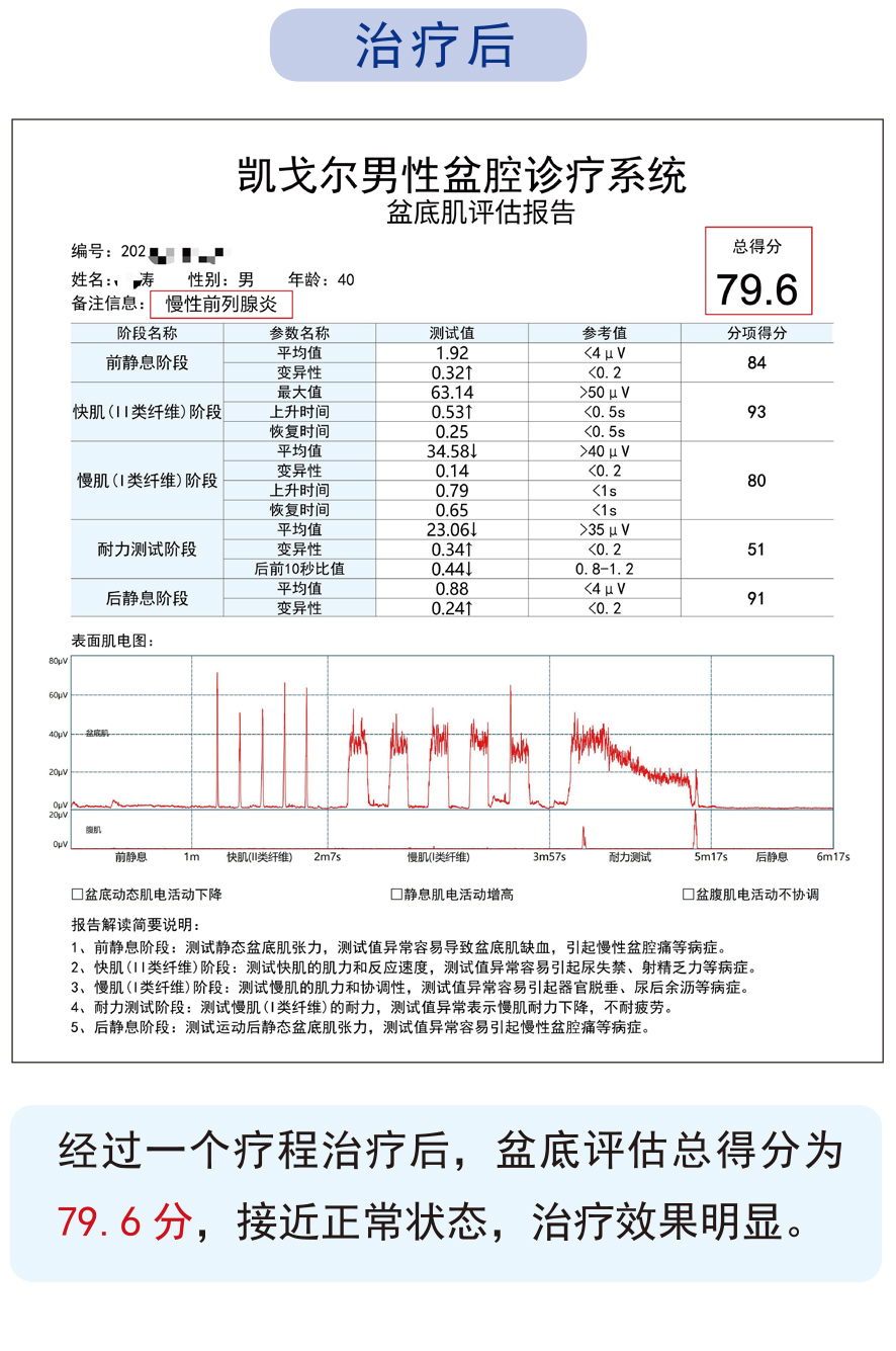 男性锻炼盆底肌的功效与作用,男性盆底肌群锻炼器材