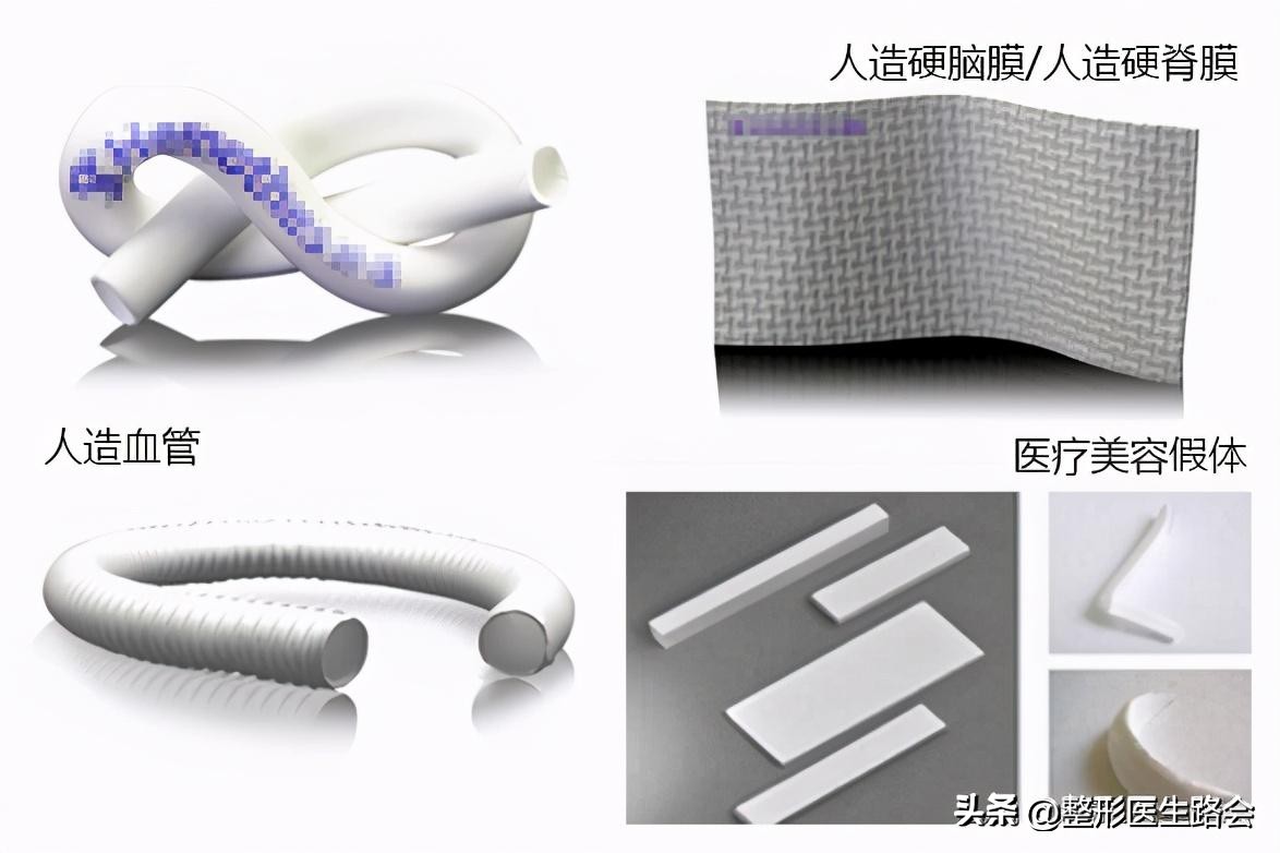 千万别做硅胶隆鼻,千万不要做玻尿酸隆鼻