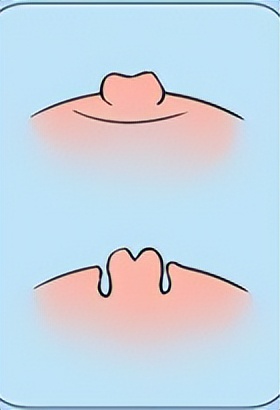 胸部长的褐色小点是什么,女生胸部上长了白色小点点