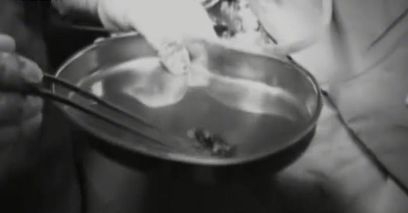 故事:江苏70岁老人头疼欲裂,检查时发现颅内有*弹子**,吓坏在场医生