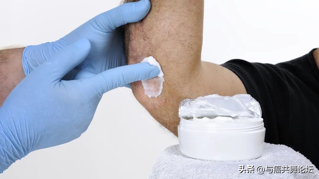 放疗后用芦荟胶用哪个牌子比较好,放疗后皮肤瘙痒可以用皮炎平吗